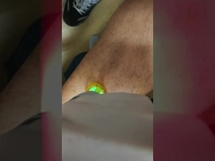 755nm Alexandrite Laser Hair Removal